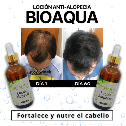 BIOAQUA Loción Alopecia